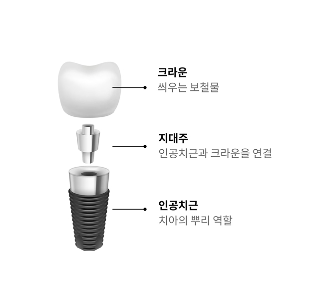오른쪽 영역 이미지